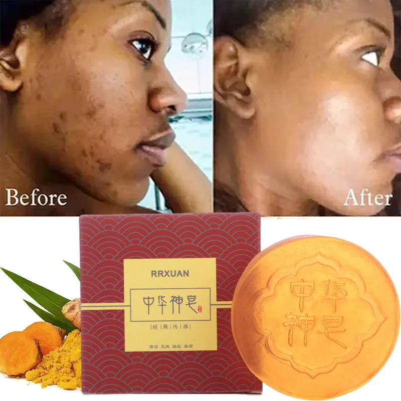 Turmeric Whitening Soap Dark Spots Blackhead Acne Removal Fade Acne Scars Oil Control Shrink Pore Fade Spots Brighten Skin Care