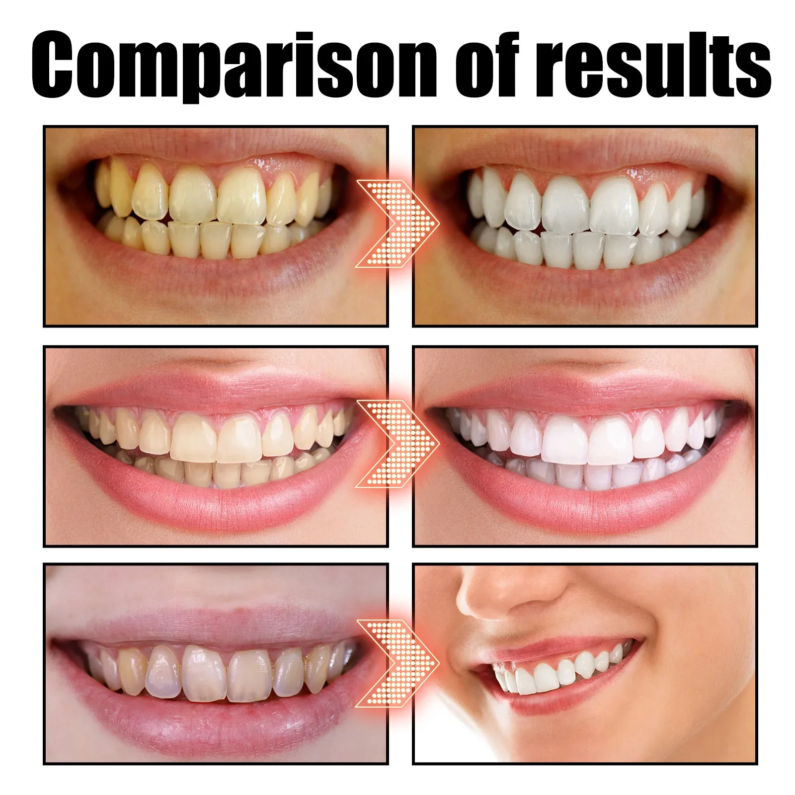 Coco Hortelã Puxando Óleo Bocal, Clareamento dos Dentes, Respiração Oral Fresca, Raspador de Língua, Cuidados de Saúde Bucal, Sem Álcool