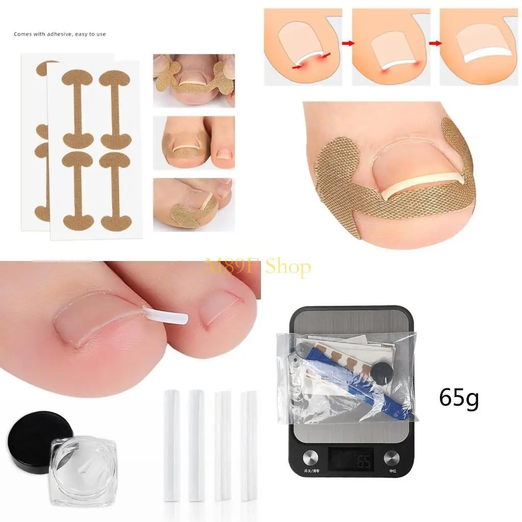 M89f Ingne piede unghia sede strumento pedicure strumento pedicure strumento piede in unghie dei piedi.