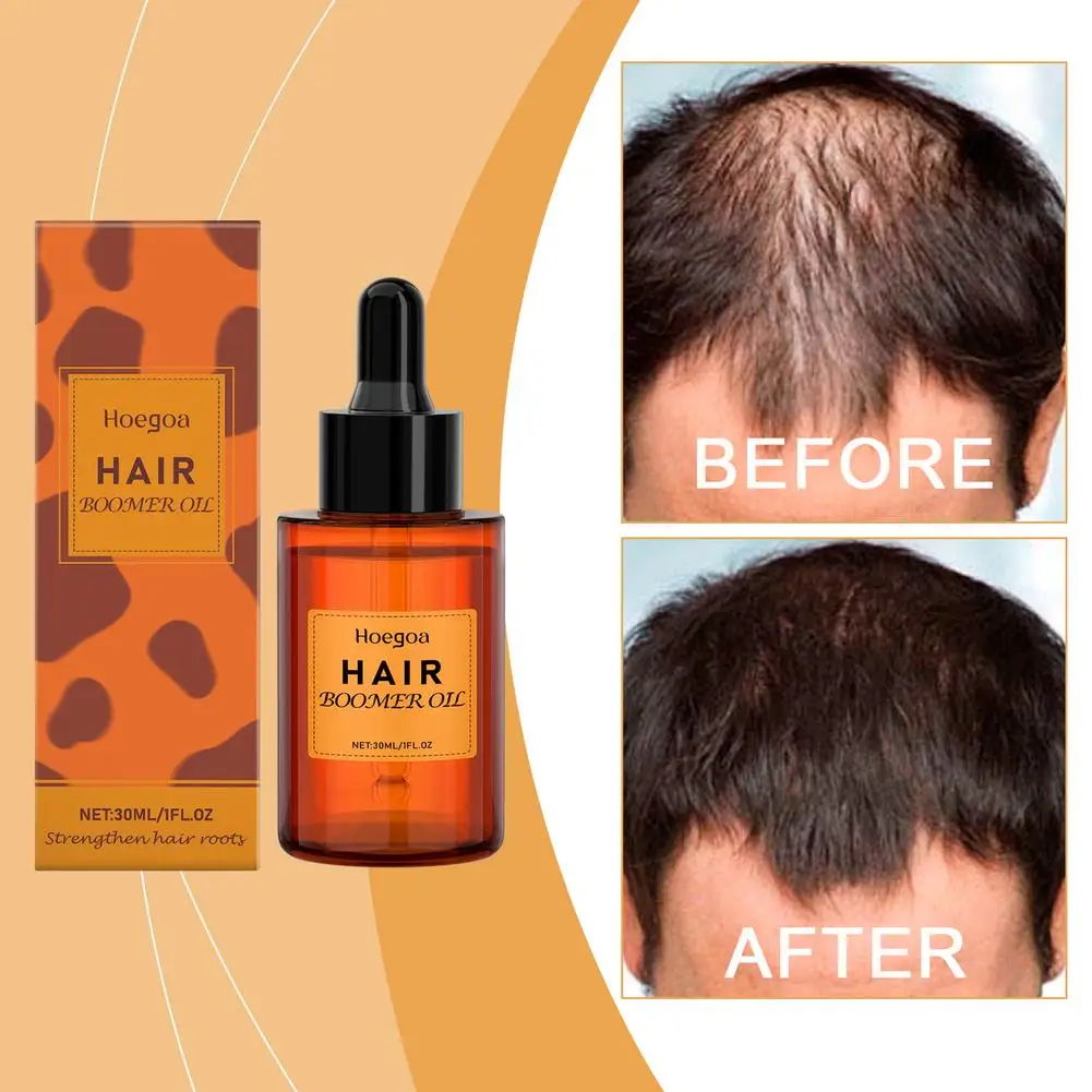 

Питательная и уходовая сыворотка для волос: нежно уход и питает кожу головы, объем волосы, сыворотка для ежедневного ухода Q3C4