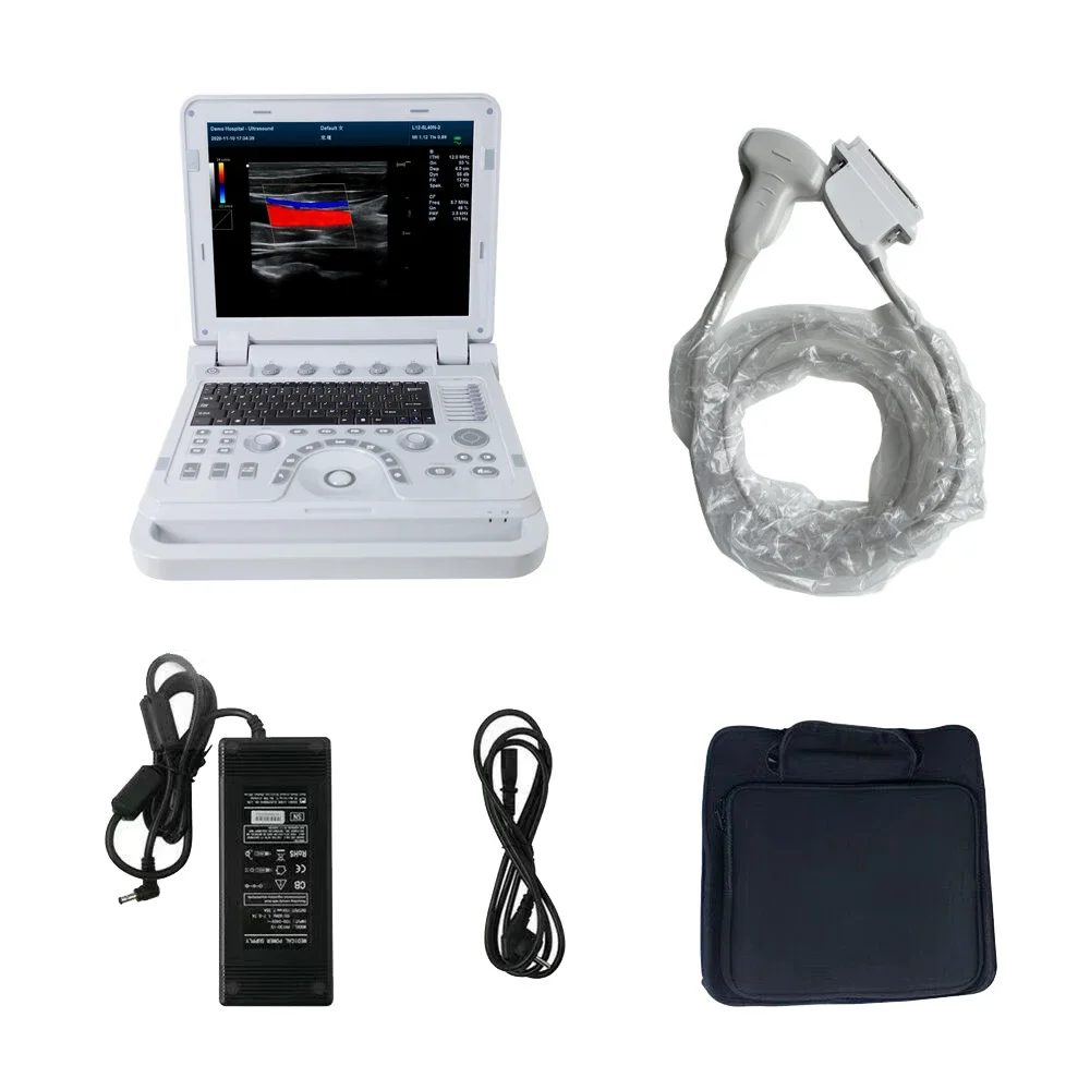 CONTEC CMS1700B Professional Diagnostic  cardiology ultrasound cardiology color doppler