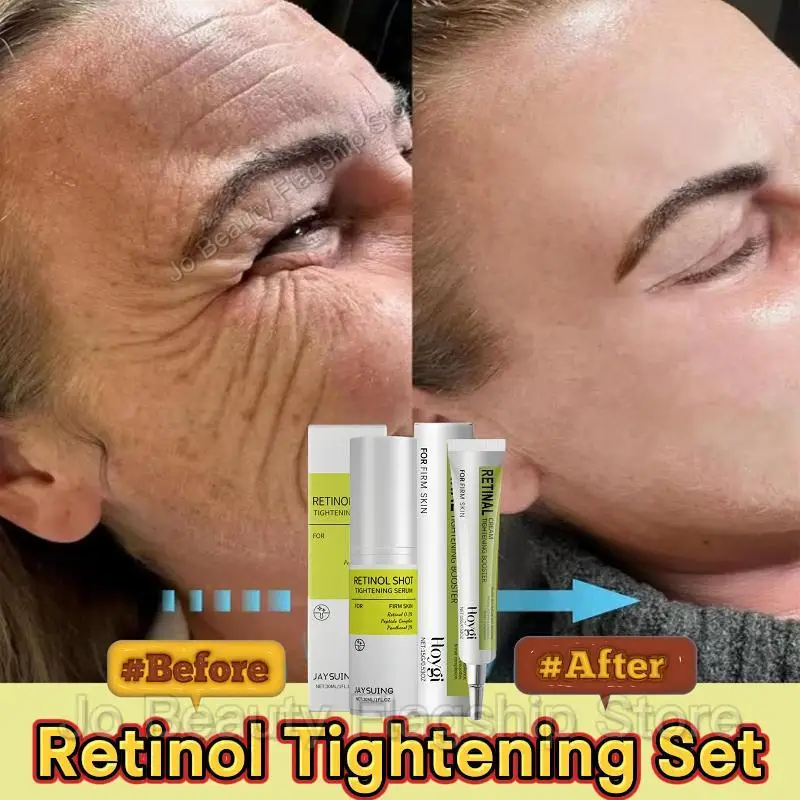 

Retinol Wrinkle Remover Cream Shot Tightening Firming Fine Line Enhancer Moisturizing Pore Shrinking Repair Serum Skin Care Set