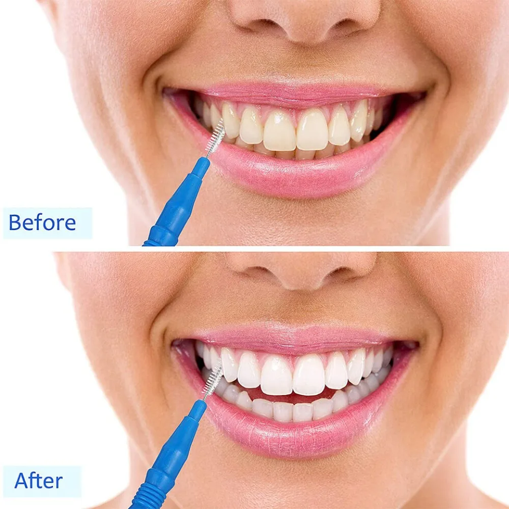 

20pcs/set Practical Plastic Interdental Brush Oral Hygiene Teeth Clean Tooth Floss Dental Orthodontic Floss Sticks Oral Care