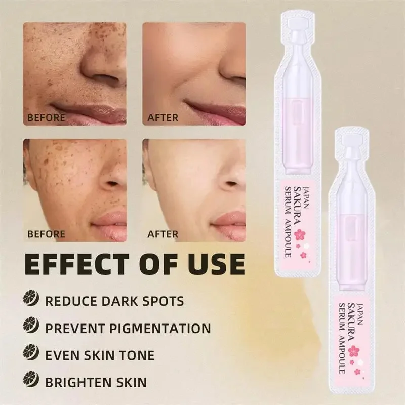 Clareador sardas rosto soro remover melasma mancha escura clareamento melanina iluminar melasma anti-envelhecimento essência produto de cuidados com a pele