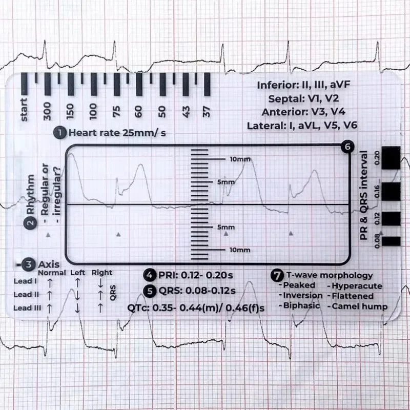 ECG 7 Step Ruler  Portable Heartbeat Ecg Observation 7-Step Scale Measurement Tool Ruler for Ecg Interpretation