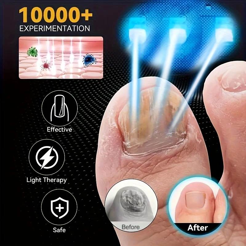 

1/2/4 Pcs Nail Fungus Light Device for Multiple Fingernails & Toenails