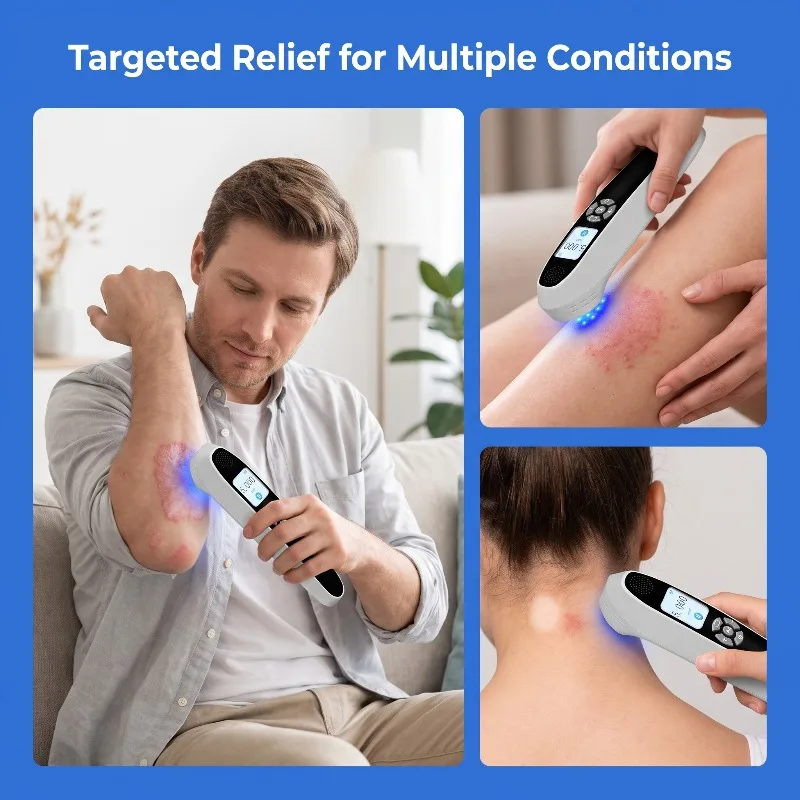 GOVW 308nm UVB Light Therapy Device Phototherapy laser lamp 9Diodes 55mW Excimer Laser Rechargeable Portable for Vitiligo Eczema