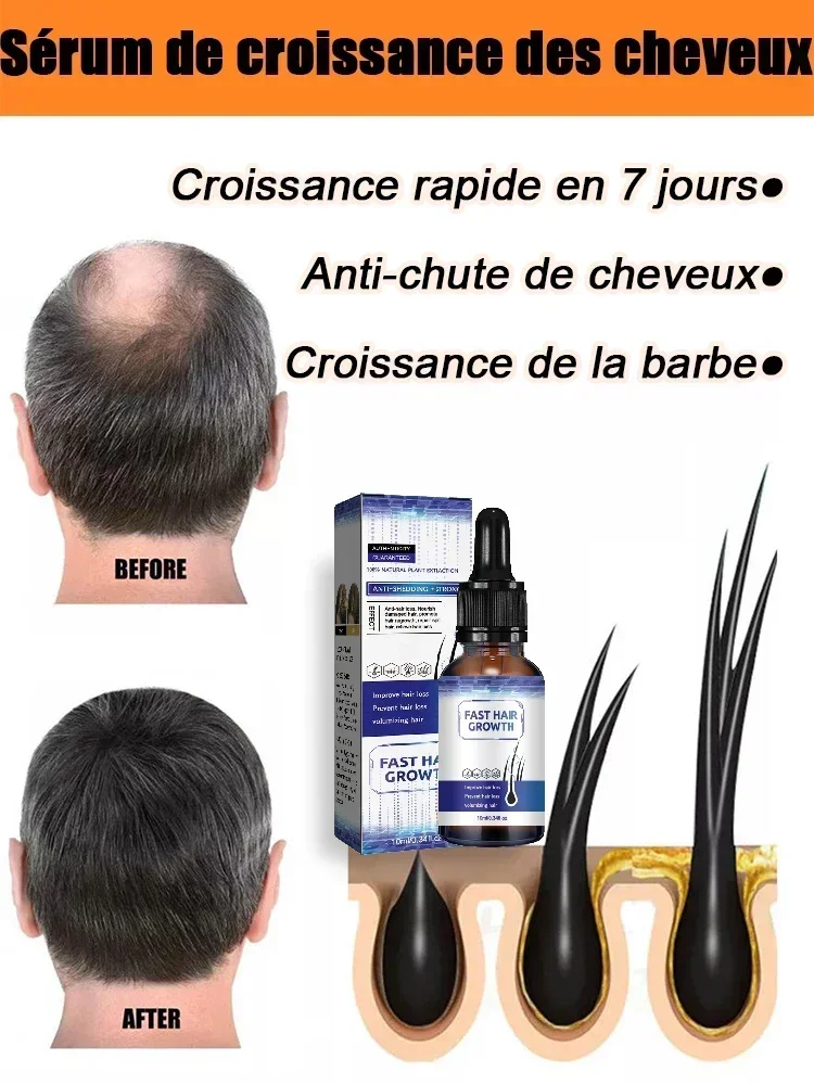 

Hot selling product, 99% of buyers buy again, have more and more hair, say goodbye to baldness, thick hair