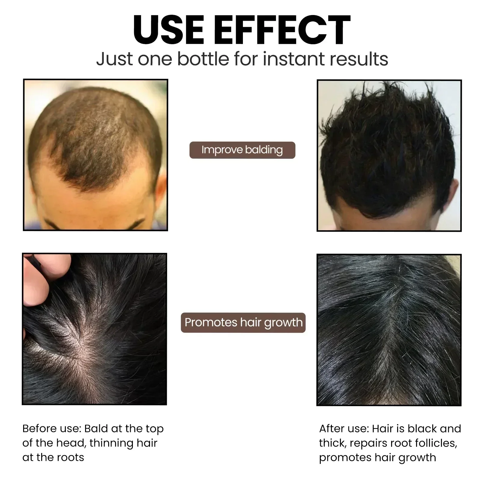 Serum penumbuh rambut cepat, perawatan Anti rambut rontok, menipiskan kulit kepala, menyembuhkan, menutrisi akar rambut yang kuat