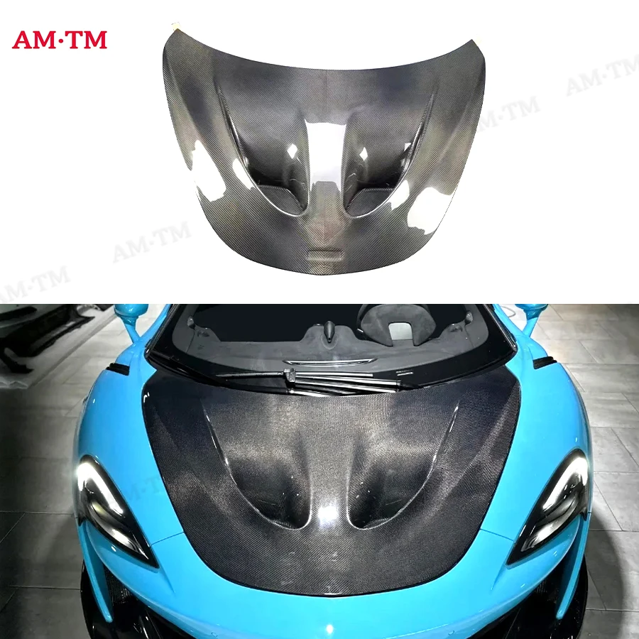 

Carbon fiber Forged carbon Hood For Mclaren 540 570s P1 Style engine cover carbon fiber cover engine cove Body Kit