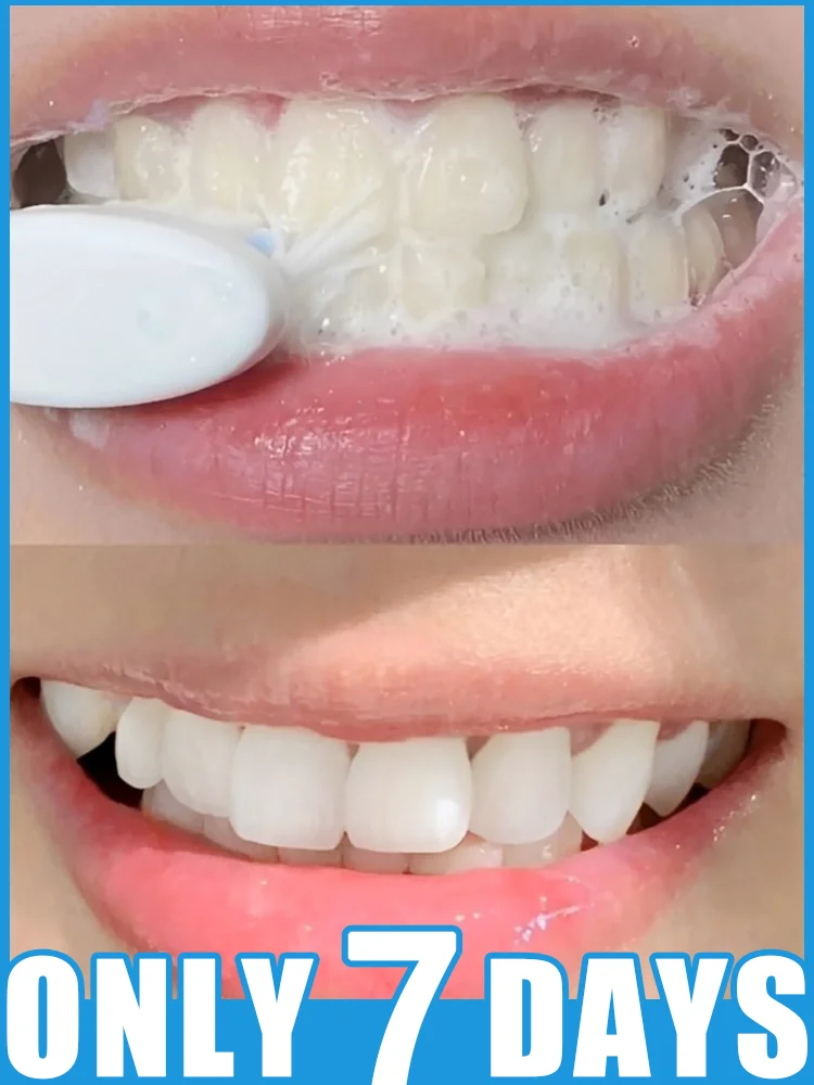 

Removes yellow stains, naturally whitens, eliminates bad breath, yellow teeth and repairs gums in just one brushing