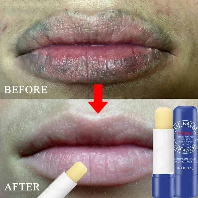 Lippenbalsam, schwarz, aufhellende Melanin-Lippenmaske, hellt Lippenlinien auf, hellt den Teint auf, Peeling, spendet Feuchtigkeit abgestorbene Haut, repariert die Lippen