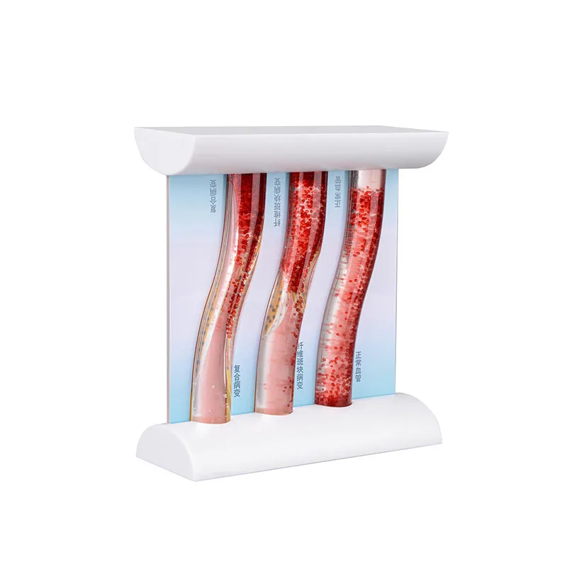 Dynamic Blood Vessel Model Cardiovascular Blockage Contrast Model Thrombosis Model Teaching Tool