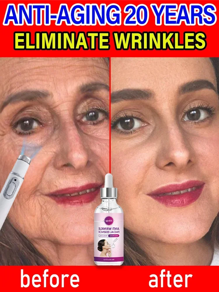 Tighten under the skin, make you look 20 years younger, support wholesale