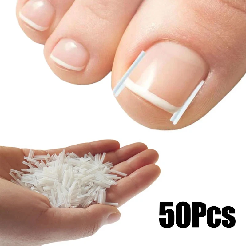 Narzędzie do korekcji wrastających paznokci, wkładka do wypełniania paznokci, leczenie wrastających paznokci, elastyczna plastra, klips prostujący, orteza, narzędzie do pedicure
