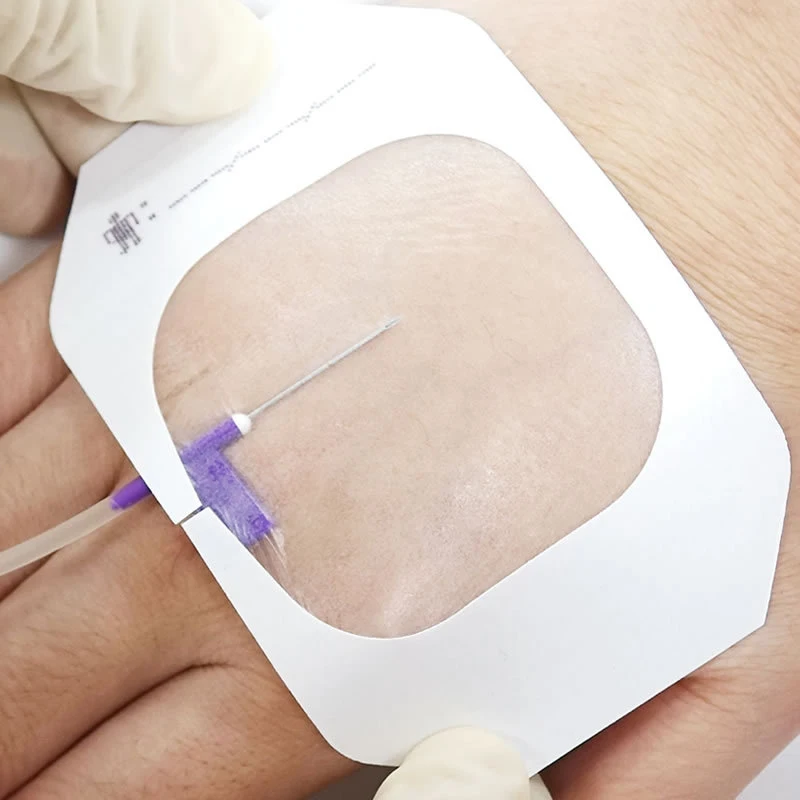 1pcs Transparent Film Dressing Wound Bandage Aseptic Waterproof Catheter Fixation Wound Protection Patch