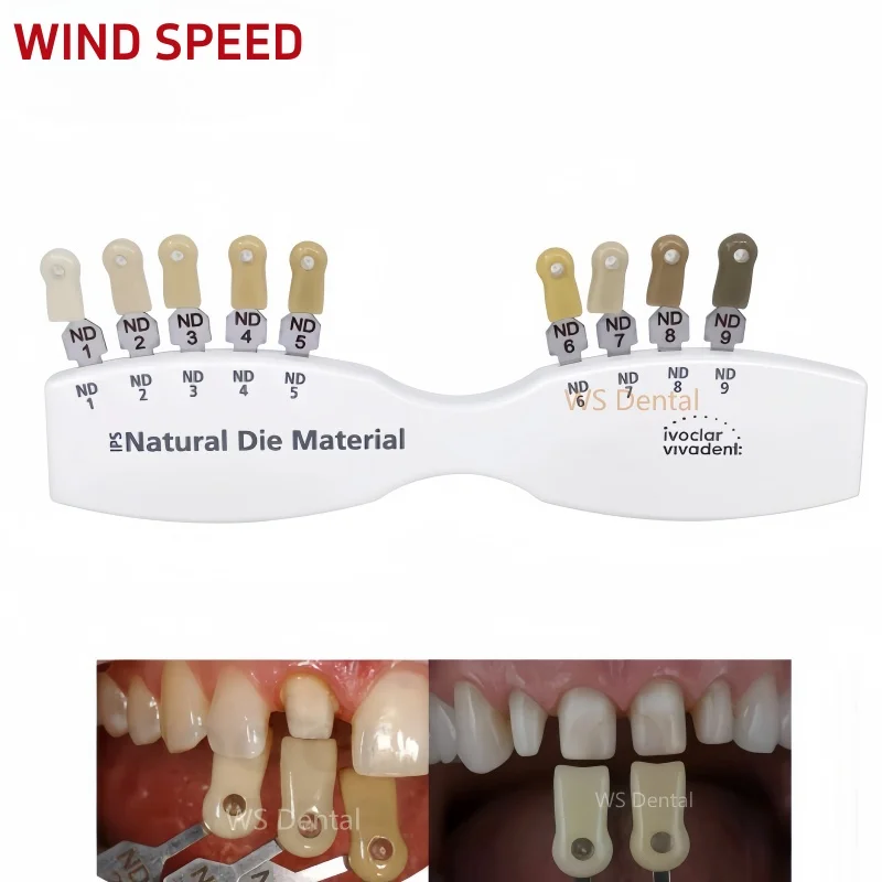 مراجعات وتحليلات لجهاز توجيه لون الأسنان Ivoclar Vivadent ND 1-9