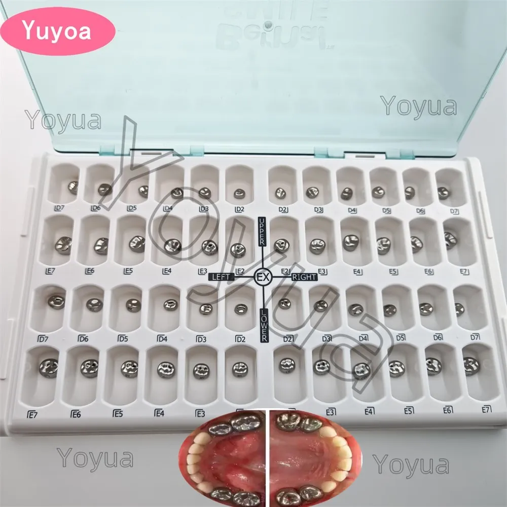 48Pcs/Box Dental Kid&Adult Crowns Primary Molar Teeth Crown Stainless Steel Orthodontic Deciduous Preformed Temporary Crown
