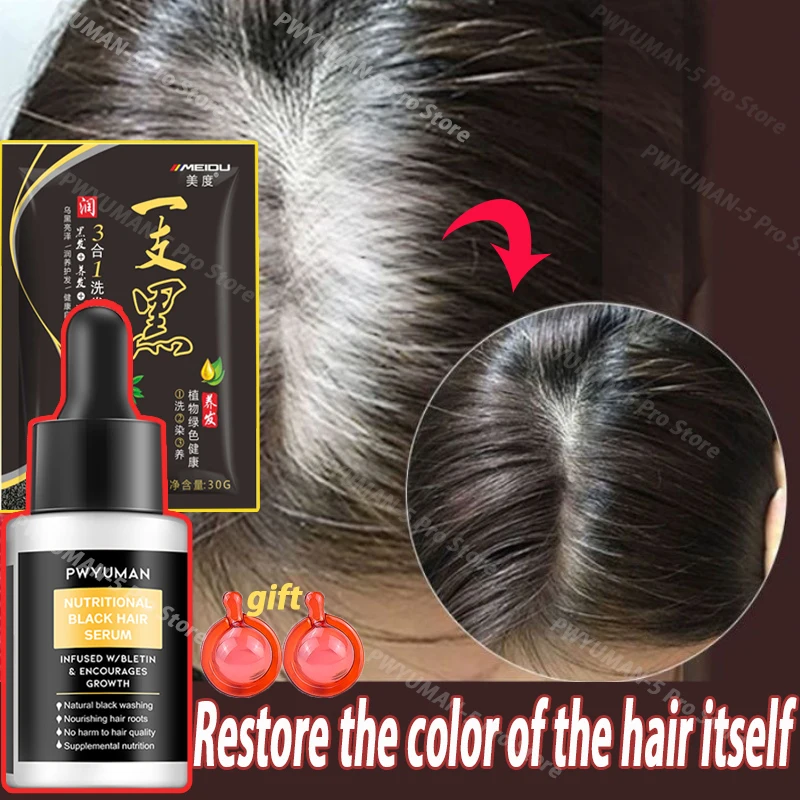 Original Anti-grey Hair Essence Serum Treat Gray White Hair Restore Natural Hair Darken Color White To Black Hair Nourish scalp