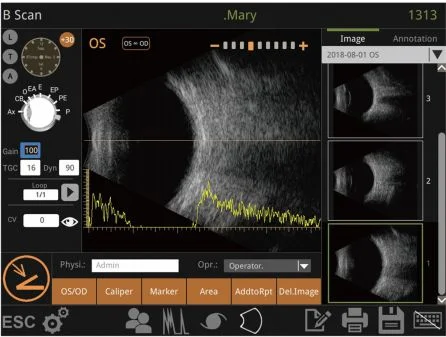 Retiwave 1000 Ophthalmic AB เครื่องสแกนจักษุวิทยา Ultrasound Scanner Eye Diagnostic สําหรับ Eye Clinic