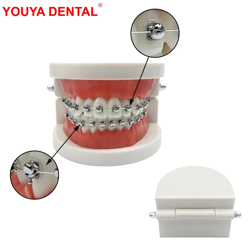 Full Self-Locking Orthodontic Model With Brackets Sphericity Metal Ortho Dental Models For Patient Education Studying Teaching
