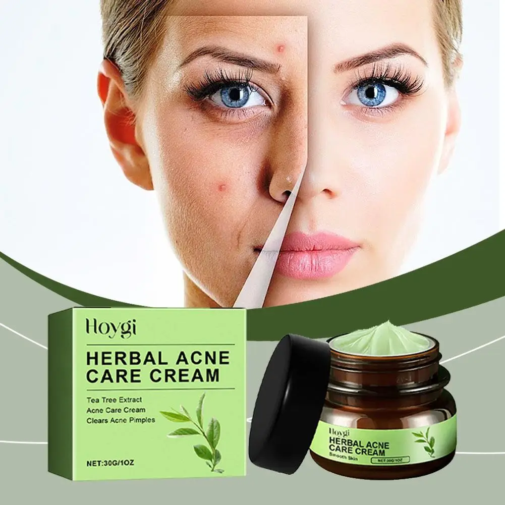 Herbal Acne Cream Shrink Pores Refining Cream Oil Control Blackhead Moisturizing Care Remover Nourishing Skin Korean Produc B8U8