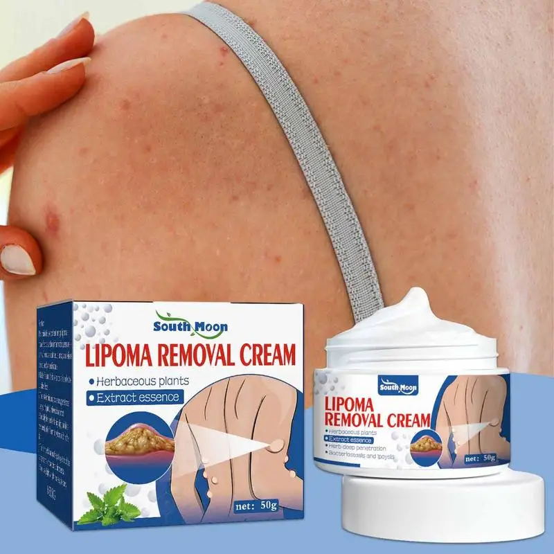 50g Lipoma Removal Cream The Whole Body Multiple Subcutaneous Conditioning Cream Eliminate Paste Fiber Paste Skin Care