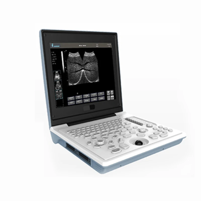 

laptop type black white ultrasound scanner with good price