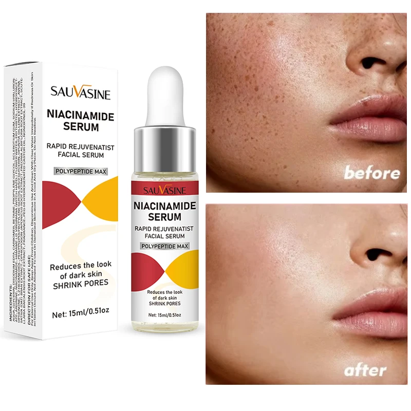 15ml Original Niacinamide Serum Dark Spot Remover Face Cream Whitening Hyaluronic Acid Brightening and Hydrating Skincare