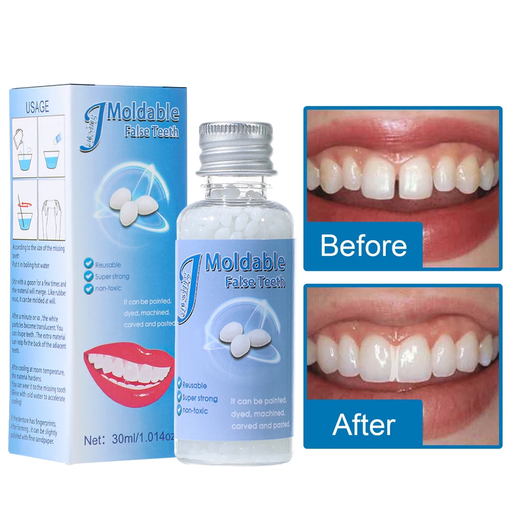 30ml Resin Temporary Tooth Repair Solid Gel Granules Broken Tooth Gaps False Teeth Moldable Filling Adhesive Dental Supplies