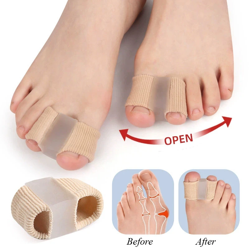 Séparateur d'orteils en Silicone, correcteur d'oignon Hallux Valgus, pouce, doigt, lisseur de Correction en Nylon, outil de soins des pieds, 2/1 pièces