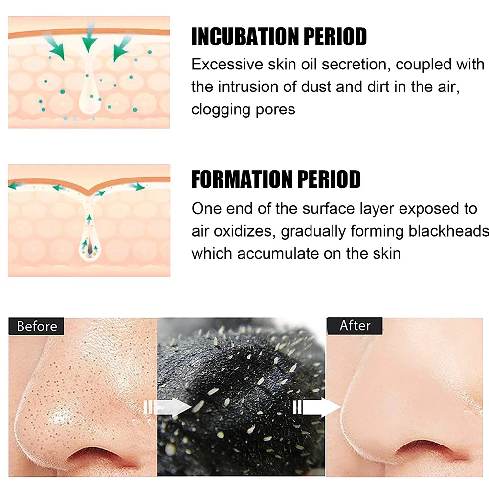 10 pièces unisexe points noirs enlever masque bandes nasales rétrécissement nettoyage pores nez tête noire enlever autocollants soins de la peau masque Patch