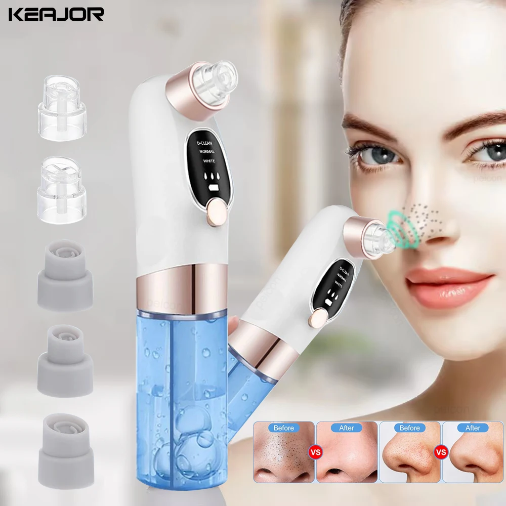 

Electric Vacuum Blackhead Remover Bubble Water Cycle Face Dead Skin Acne Pore Cleansing Suction Blackheads Removal Instrument