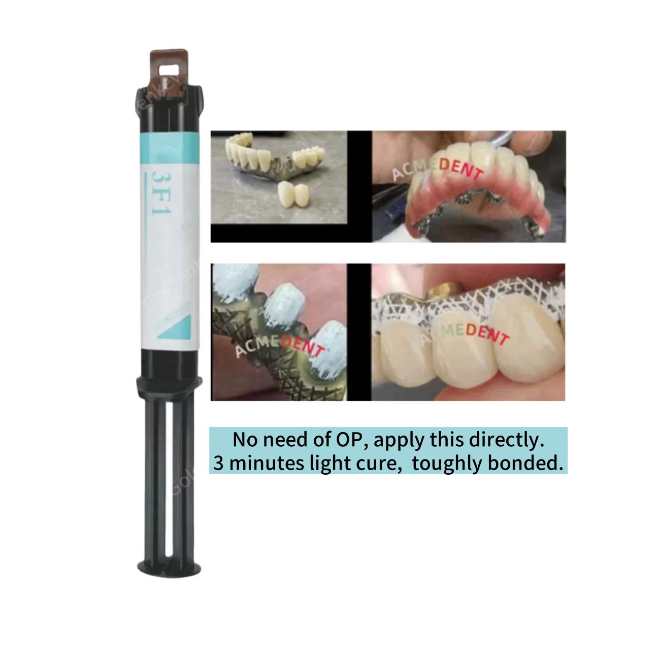 

Dental Cement Resin High Masking NO NEED OP Mask Metallic Maryland Bridge