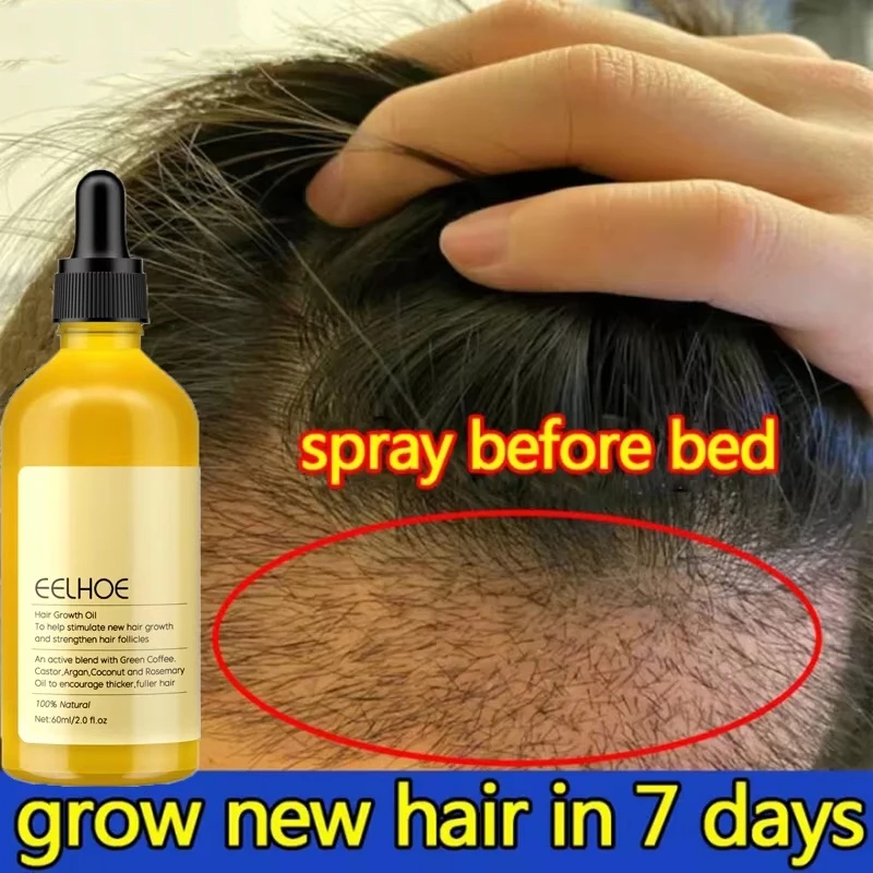 Fast Hair Growth Oil Africa Crazy Traction Alopecia Serum Anti Hair Break Thicken Hair Loss Treatment Spray For Man Women 60ML