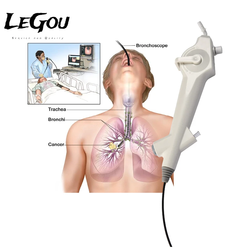 

Compact Disposable Bronchoscope Professional Electronic Endoscope For Hospital Pulmonary Department UseLeGou Professional