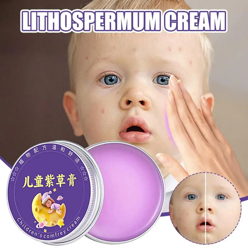 

Skin Antipruritic Cream Anti Bite Ointment Anti Bite Cream Summer Body Refreshing Cream 30g Natural Cooling Relief For Kids