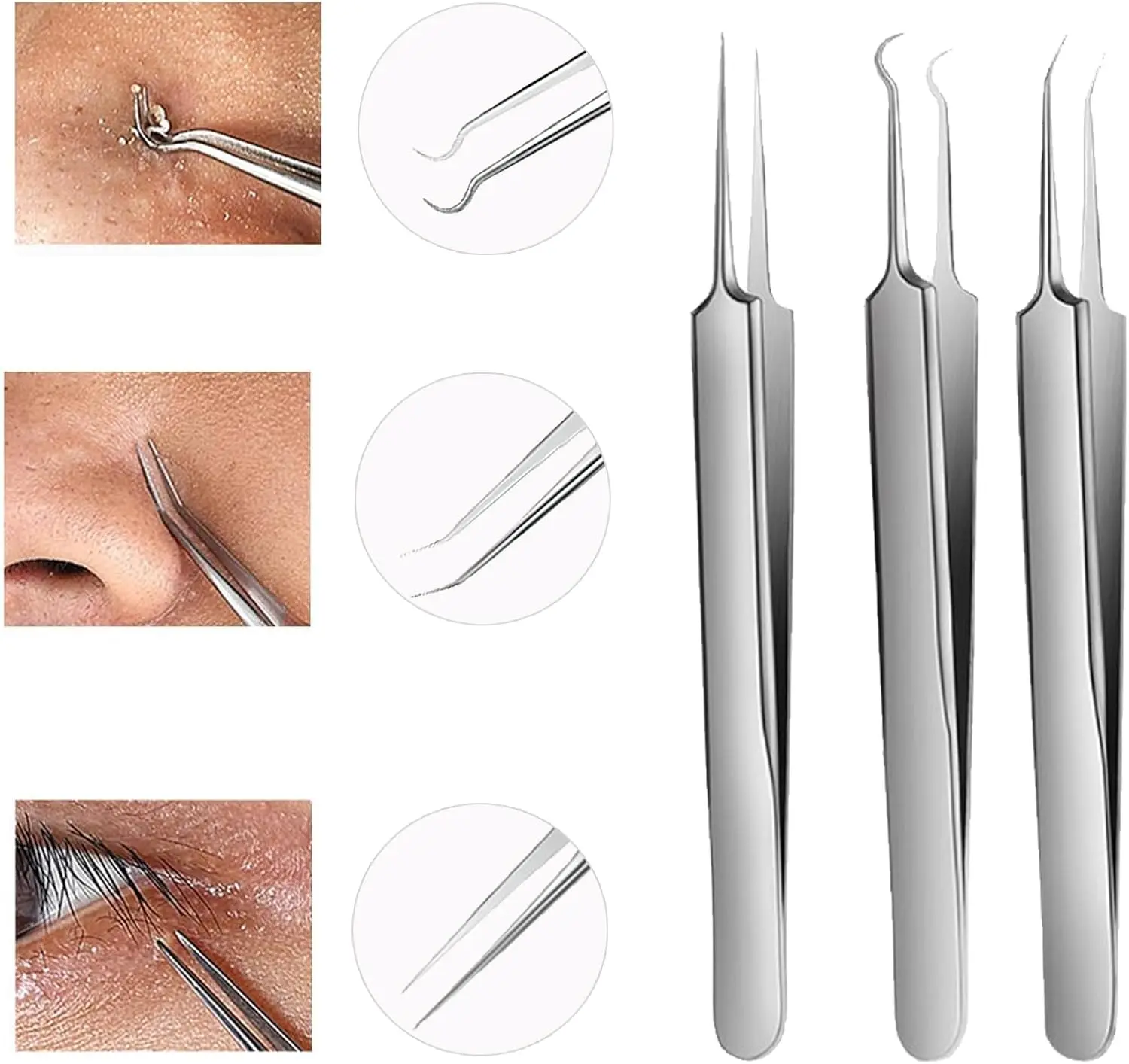 Mee-eter pincet, mee-eter extractor, puistje popper tool kit, professionele roestvrijstalen huid Zit acne smet popping chirurgisch