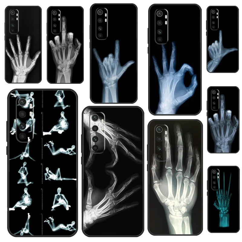 X-Ray Hand Bones Fu… - image