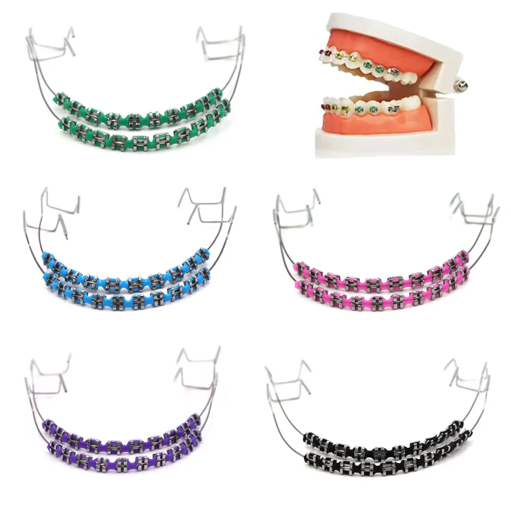 Braces Jewelry for Teeth 2 pcs, Colorful Dental Sparkle Chains for Girls Teens, Cute Orthodontic Decoration Party Gift