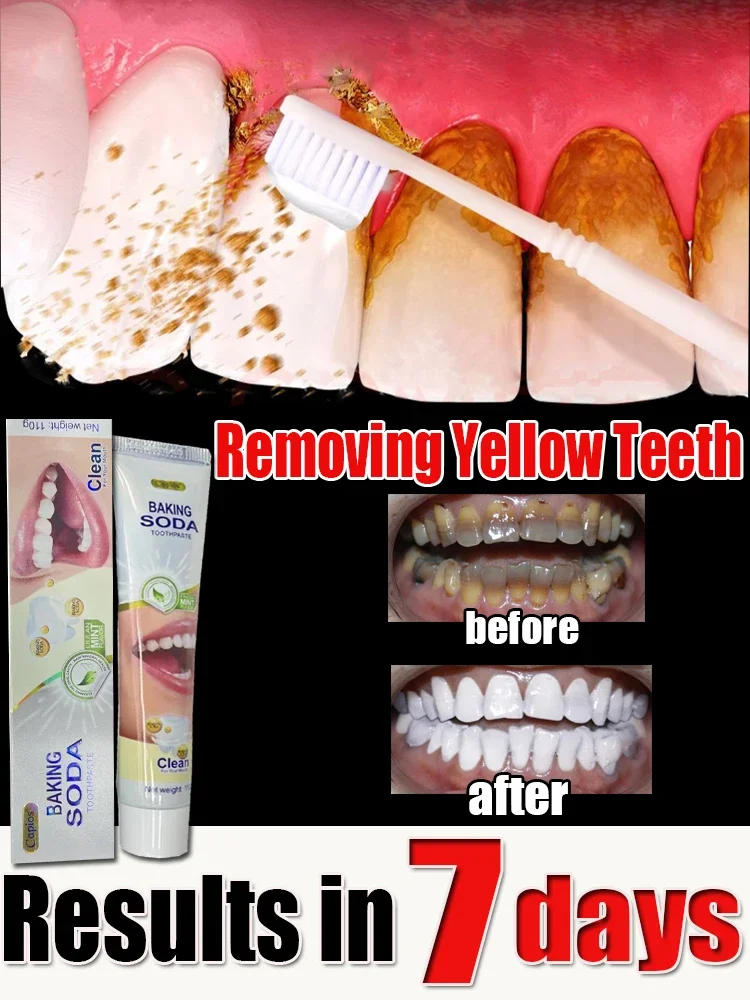 Remover Dental Calculus Whitening Teeth Mouth Odor Removal Bad Breath Preventing Periodontitis