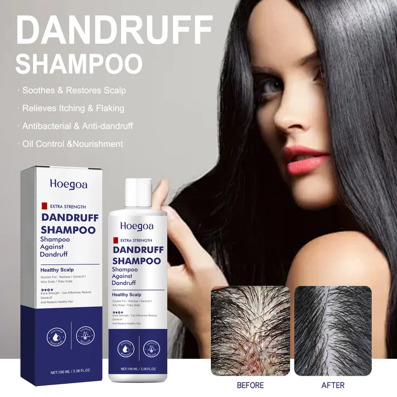 

Scalp Care Shampoo for Dandruff - Gentle Cleansing Formula Helps Reduce Flakes & Soothe Itchy Scalp for Healthier Hair