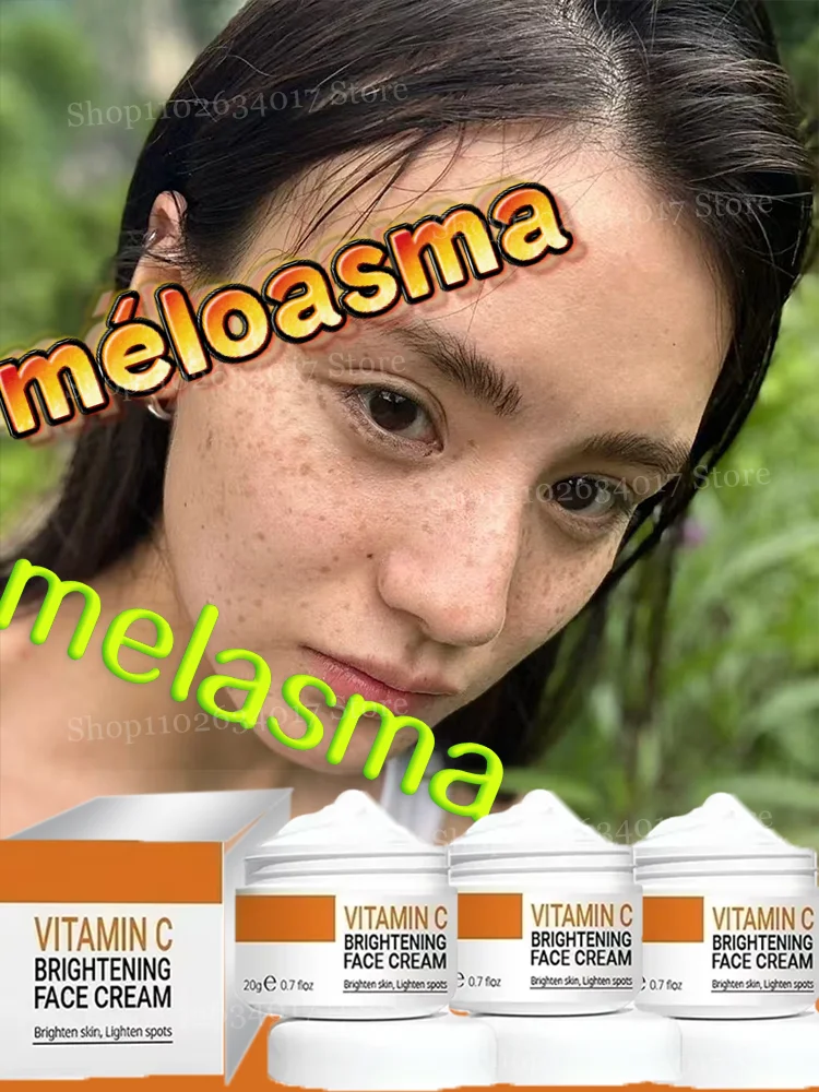 

Spot cream, directly hit the spot source, inhibit melanin, appearance level of the great savior