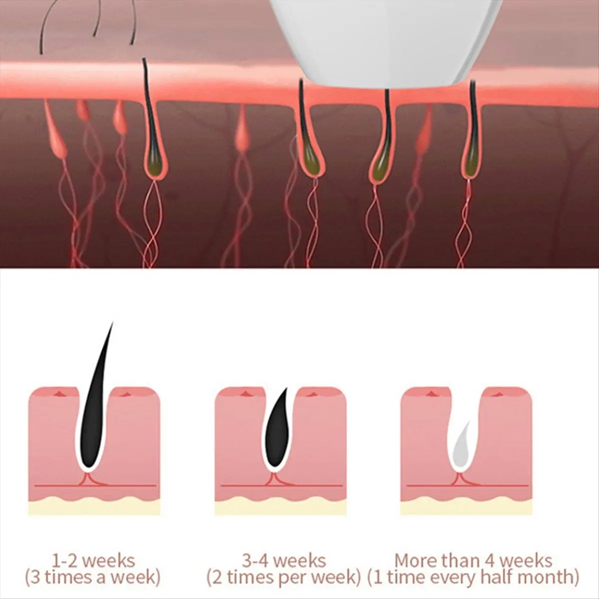 abit-hair-removal-epilator-for-women-flash-depilator-lcd-pulses-permanent-epilator-painless-hair-removalus-plug