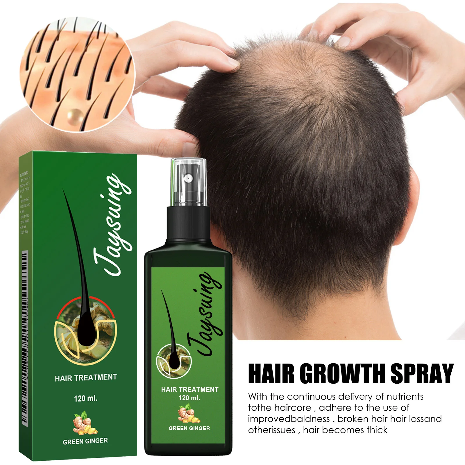 Hair Growth Spray Ginger Massage Scalp Damaged Treatment Solution Nourish Roots Fast Grow Anti Hair Loss Serum Beauty Health - view 2