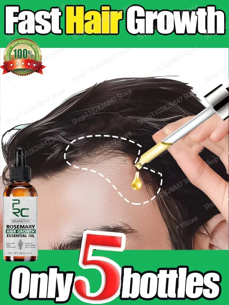 Hair Growth Products Biotin Anti Hair Loss Spray Scalp Treatment Fast Growing AHair Care Essential Oils for Men Women AHair Care