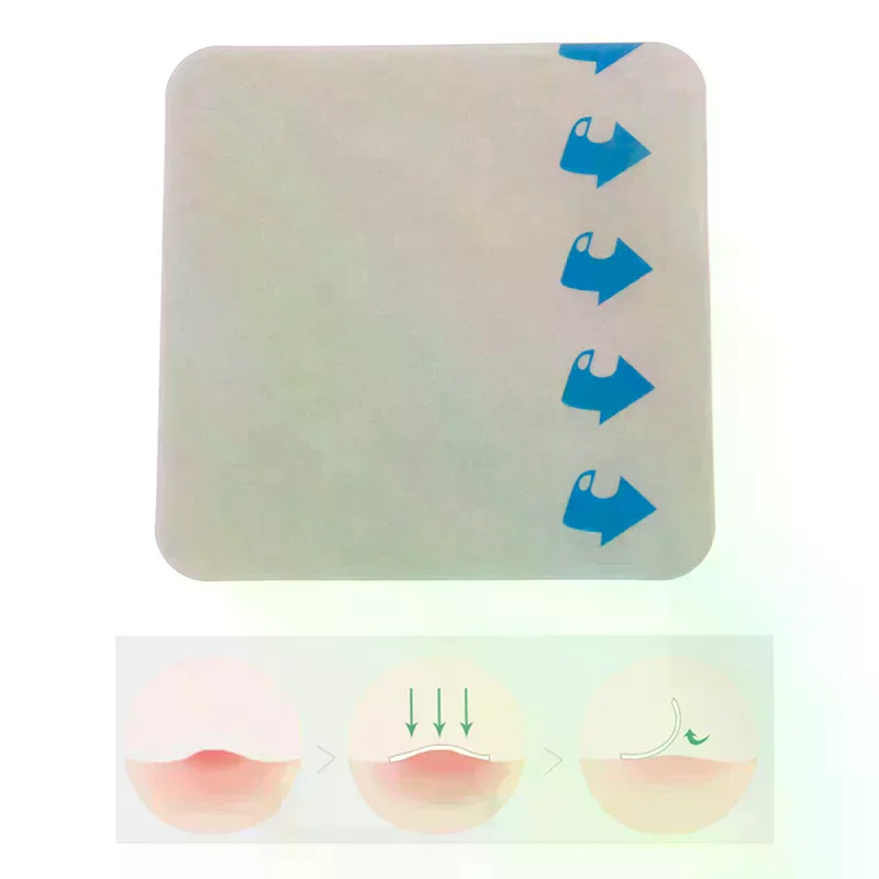 /YOV/Adhesive Dressing Wound Dressing Sterile Thin Healing Pad Patches Hydrocolloid