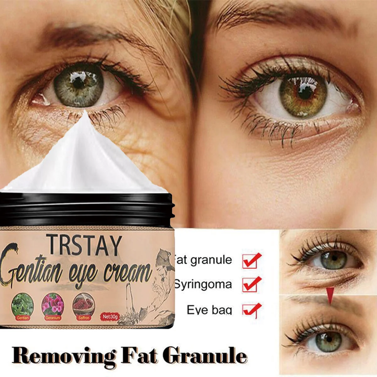 

TRSTAY крем для глаз, увлажняющий, восстанавливающий, устранитель темных кругов, уменьшающий морщины, против отечности, отбеливатель кожи для мам и детей