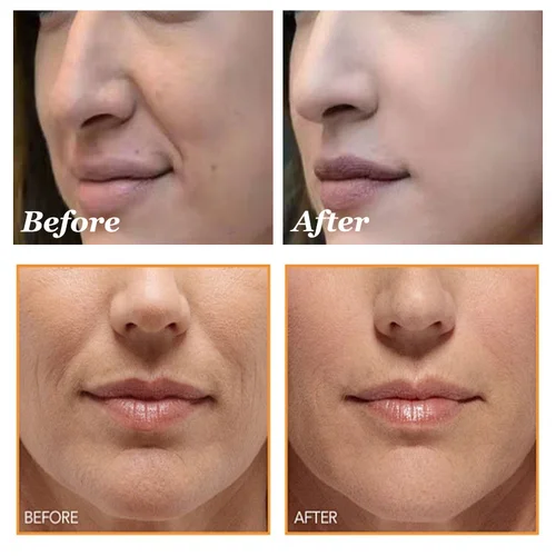 Imagen 2 del producto Removedor de arrugas de sangre de dragón, conjunto facial reafirmante instantáneo, suero antienvejecimiento que se desvanece, blanqueamiento de líneas finas, producto coreano para el cuidado de la piel