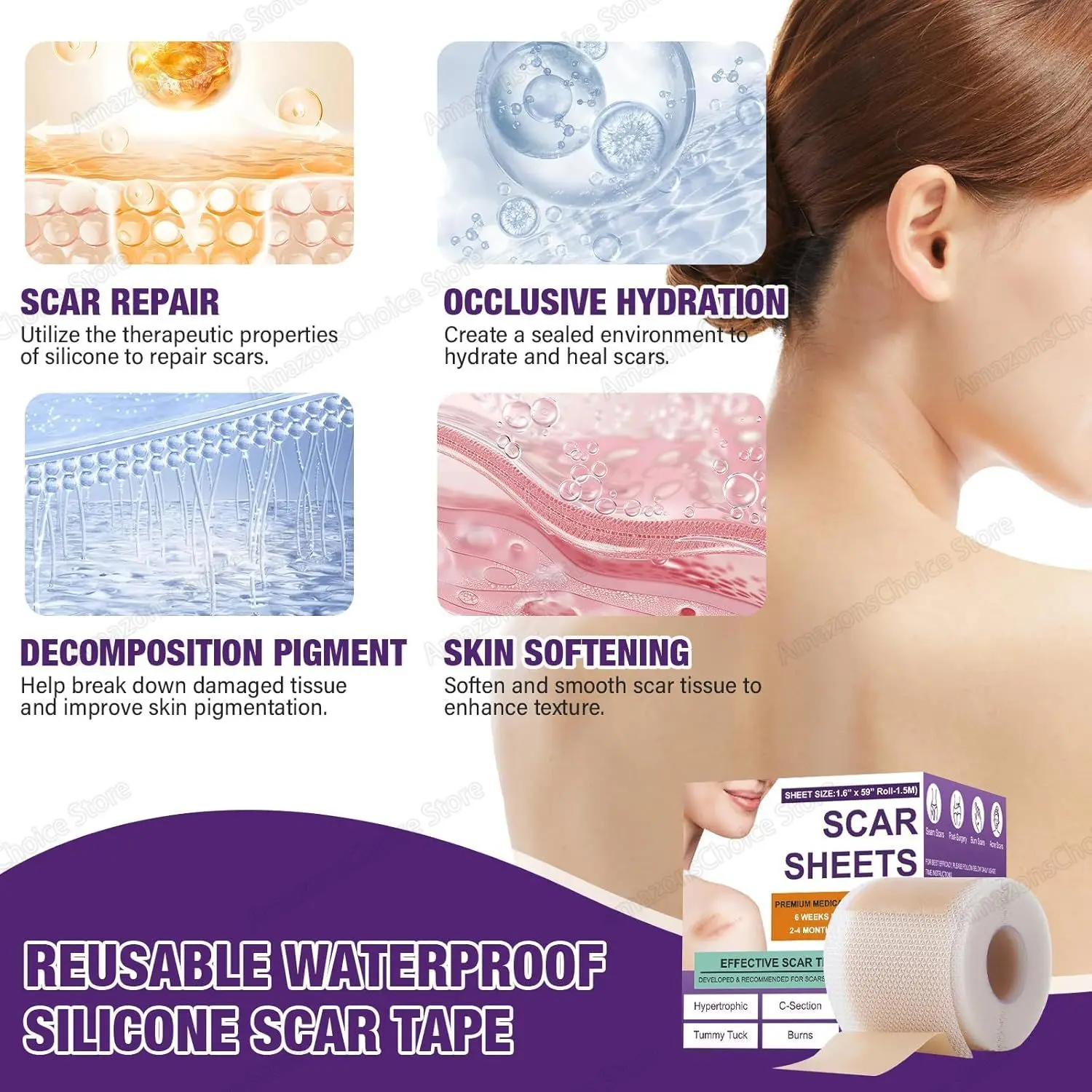 0.5M/1.5M/3M*4cm Silicone Scar Sheets Removal Strips Silicone Gel Scar Strip For Acne Keloid Surgery Burn Treatment Scar Patch image 5